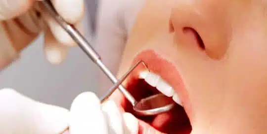 Dentisterie générale à Bruxelles - iDent clinic