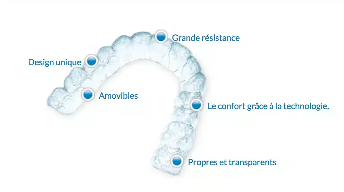 Orthodontic treatment in Brussels - open bite